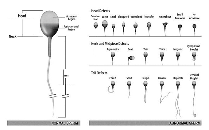 Morphology مورفولوژی آنالیز اسپرم